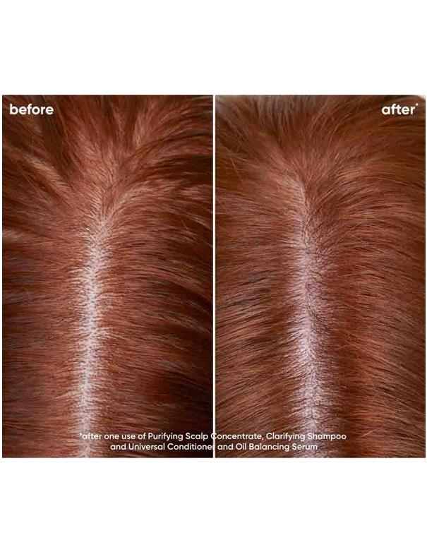 Biolage Scalp Sync Clarifying Shampoo - 400ml