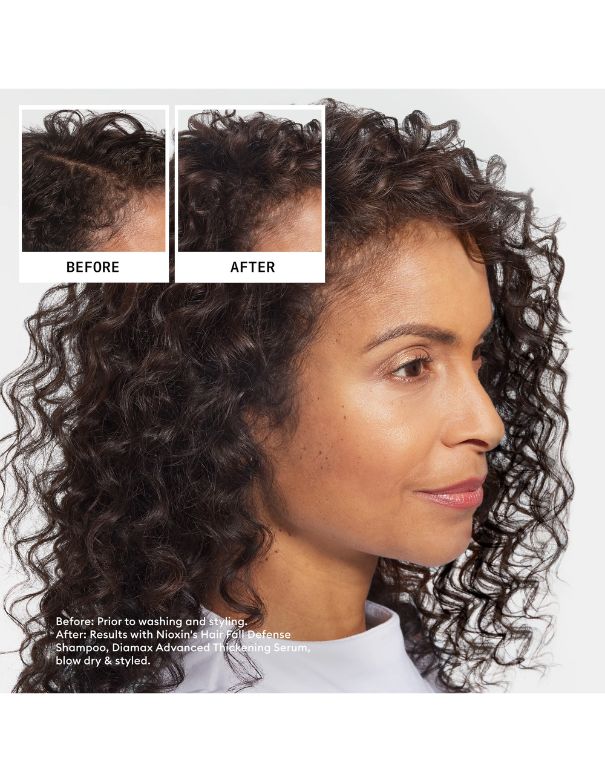 Shampooing antichute Nioxin - 240 ml