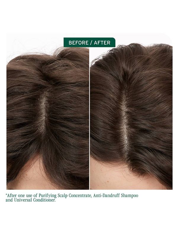 Shampooing antipelliculaire Matrix Biolage Scalp Sync - 400 ml