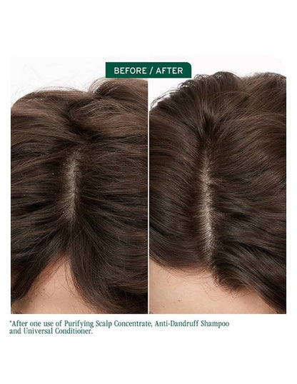 Shampooing antipelliculaire Matrix Biolage Scalp Sync - 400 ml