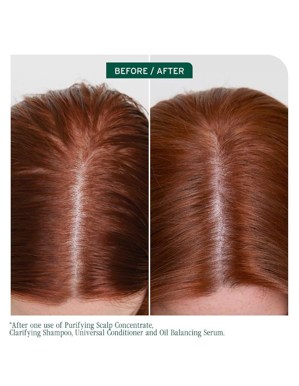 Shampooing clarifiant Matrix Biolage Scalp Sync - 400 ml