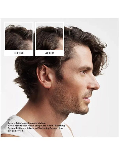 Nioxin System 2 Scalp & Hair Shampoo - 300ml