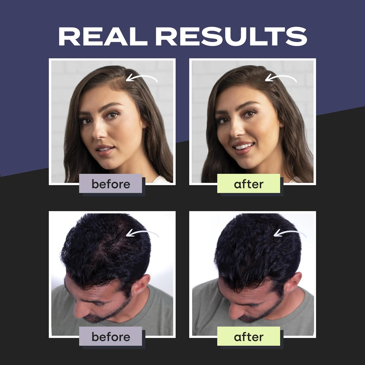 TOPPIK Hair Building Fibers (Black) - 12g